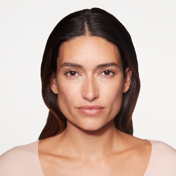 Sculptra midface volume restoration treatment before results