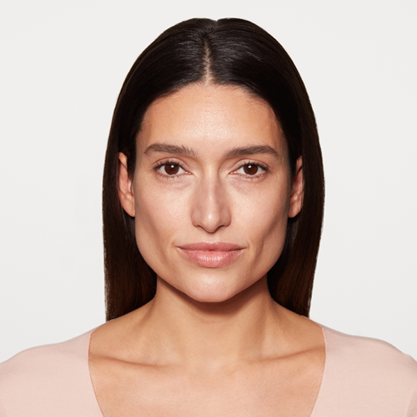Sculptra midface volume restoration treatment after results