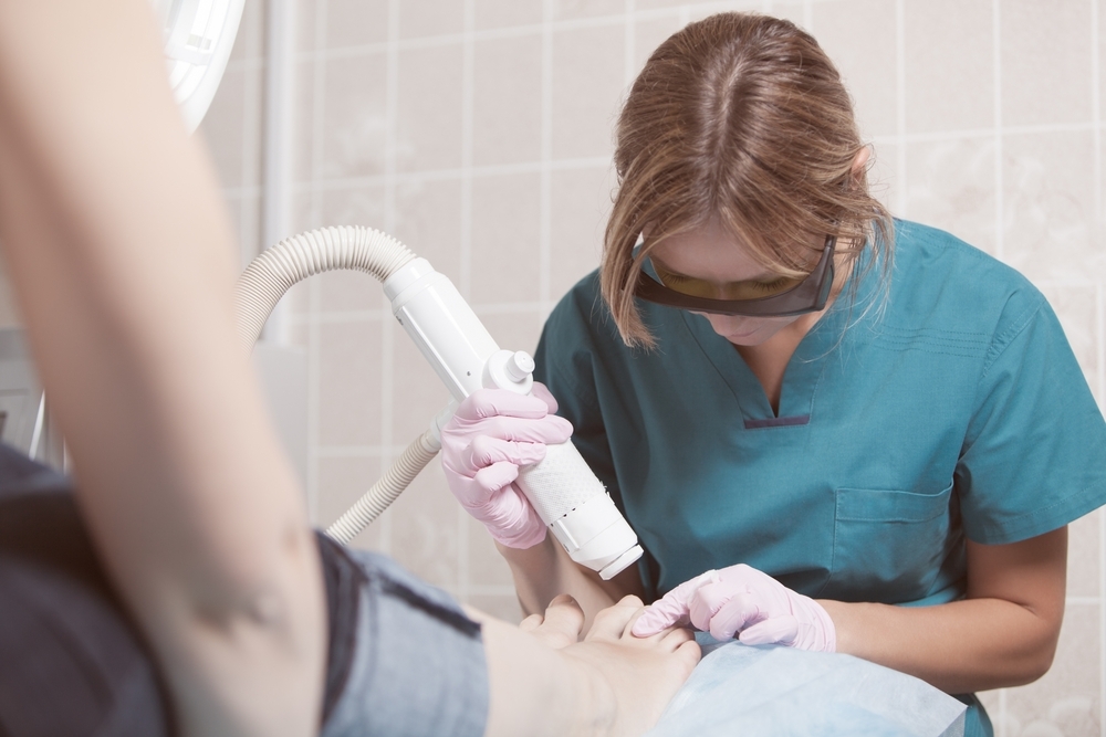 Laser Treatment for Nail Fungus