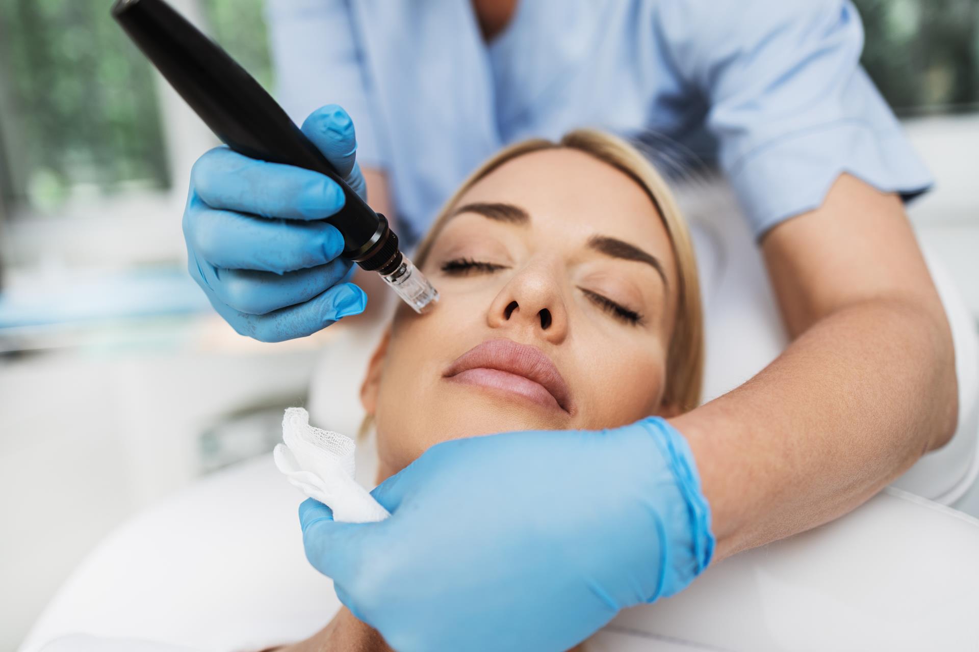 Pro Microneedling Therapy in Ridgefield